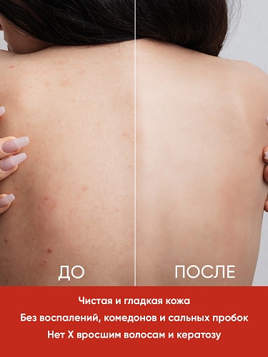 Гель для душа PROFESSIONAL против несовершенств кожи, 200 мл   Гель для душа PROFESSIONAL против несовершенств кожи, 200 мл