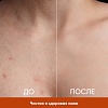 Крем для тела против несовершенств кожи EDEN PROFESSIONAL, 150 мл Крем для тела против несовершенств кожи EDEN PROFESSIONAL, 150 мл
