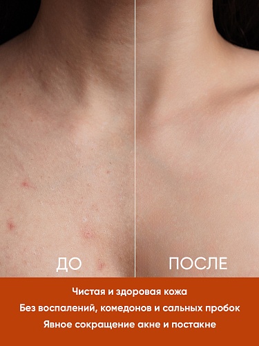 Крем для тела против несовершенств кожи EDEN PROFESSIONAL, 150 мл Крем для тела против несовершенств кожи EDEN PROFESSIONAL, 150 мл